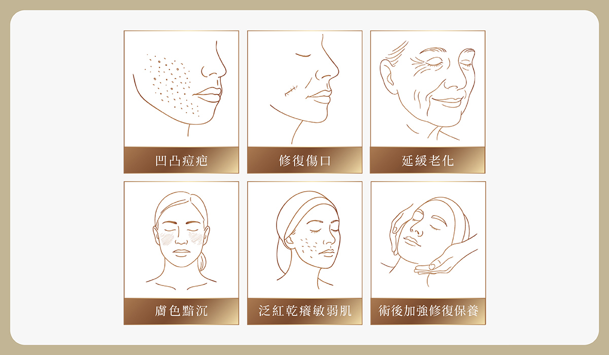 01_preventive_medicine https://sy-bac.com.tw/wp-content/uploads/2026/05/01_preventive_medicine_exovisa_-introduce_5.jpg