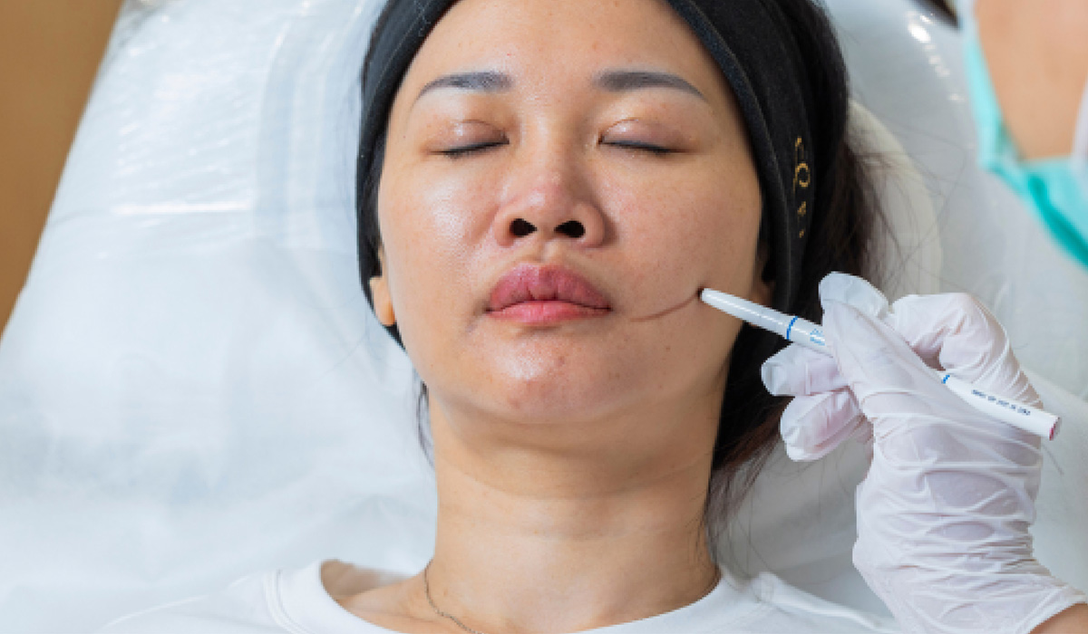 03_aesthetic medicine_A https://sy-bac.com.tw/wp-content/uploads/2026/05/03_aesthetic-medicine_A_-meteora-thread_feature_2.jpg