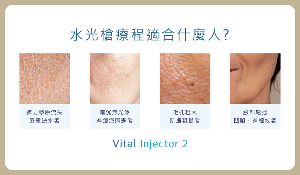 03_aesthetic medicine_B https://sy-bac.com.tw/wp-content/uploads/2026/05/03_aesthetic-medicine_B_skinbooster_introduce_3.jpg