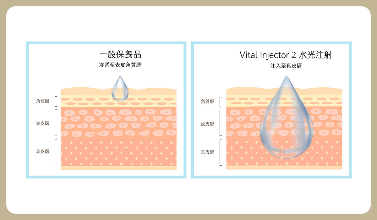 03_aesthetic medicine_B https://sy-bac.com.tw/wp-content/uploads/2026/05/03_aesthetic-medicine_B_skinbooster_introduce_4.jpg